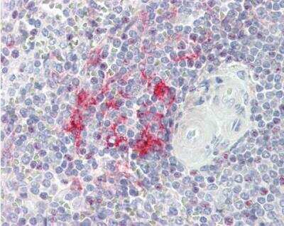 Immunohistochemistry-Paraffin: LITAF Antibody [NBP1-32726]
