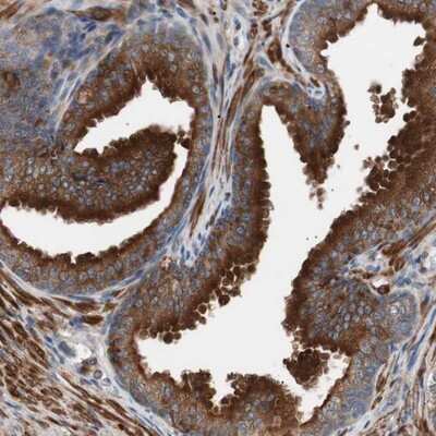 Immunohistochemistry-Paraffin: LITAF Antibody [NBP1-83473]