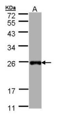 Western Blot: LITAF Antibody [NBP1-32726]