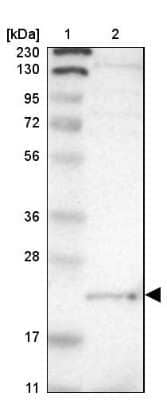 Western Blot: LITAF Antibody [NBP1-83473]