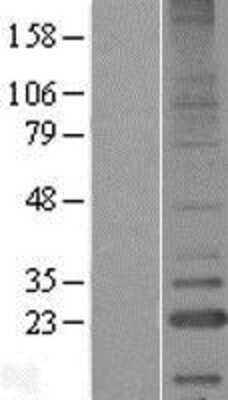 Western Blot: LITAF Overexpression Lysate [NBP2-09614]