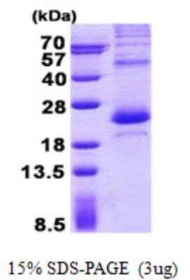 SDS-PAGE: Recombinant Human LITAF His Protein [NBP2-23200]