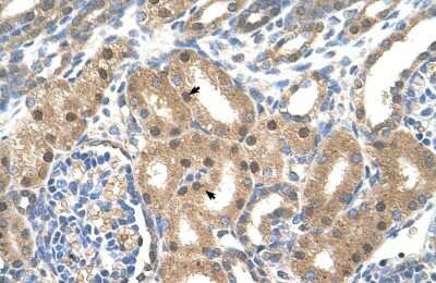 Immunohistochemistry-Paraffin: LIV-1/Zip6 Antibody [NBP1-59357]