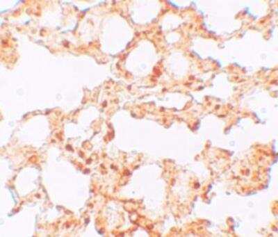 Immunohistochemistry-Paraffin: LIV-1/Zip6 Antibody - BSA Free [NBP1-76503]