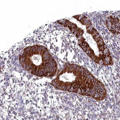 Immunohistochemistry-Paraffin: LIV-1/Zip6 Antibody [NBP2-13337]
