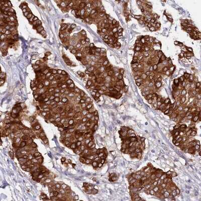 Immunohistochemistry-Paraffin: LIV-1/Zip6 Antibody [NBP2-13337]