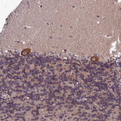 Immunohistochemistry-Paraffin: LIV-1/Zip6 Antibody [NBP2-13337]