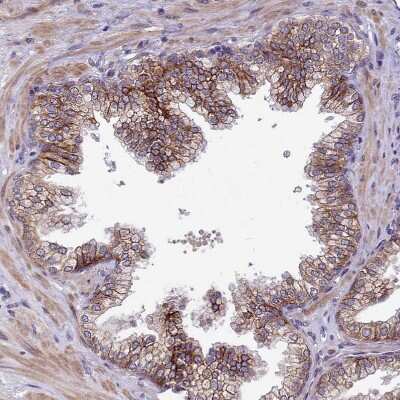 Immunohistochemistry-Paraffin: LIV-1/Zip6 Antibody [NBP2-13337]