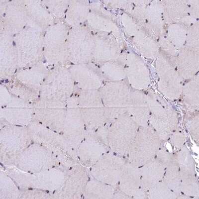 Immunohistochemistry-Paraffin: LIV-1/Zip6 Antibody [NBP2-13337]