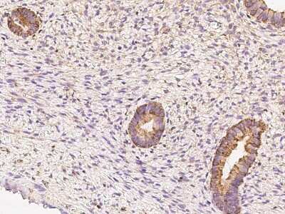 Immunohistochemistry-Paraffin: LIV-1/Zip6 Antibody [NBP2-97843]