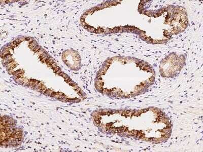 Immunohistochemistry-Paraffin: LIV-1/Zip6 Antibody [NBP2-97843]