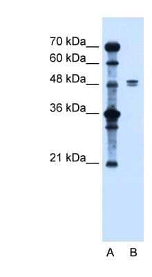 Western Blot: LIV-1/Zip6 Antibody [NBP1-59357]