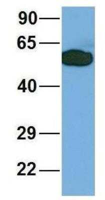 Western Blot: LIV-1/Zip6 Antibody [NBP1-59357]