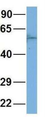Western Blot: LIV-1/Zip6 Antibody [NBP1-59357]