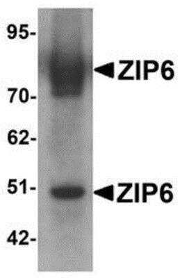 Western Blot: LIV-1/Zip6 AntibodyBSA Free [NBP1-76503]