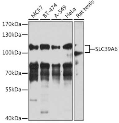 Western Blot: LIV-1/Zip6 AntibodyBSA Free [NBP3-03505]