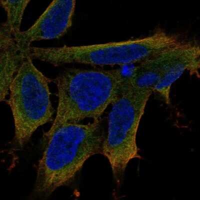 Immunocytochemistry/ Immunofluorescence: LIX1 Antibody [NBP2-31556]