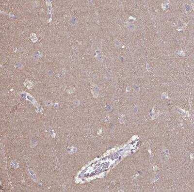 Immunohistochemistry-Paraffin: LIX1 Antibody [NBP2-31556]