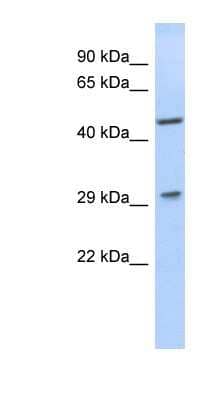 Western Blot: LIX1 Antibody [NBP1-56637]