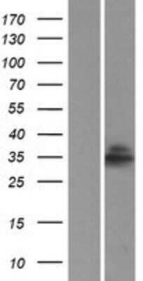 Western Blot: LIX1L Overexpression Lysate [NBP2-05222]