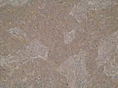 Immunohistochemistry: LKAAEAR1 Antibody (Z36P2C1*E7) - BSA Free [NBP2-50477]