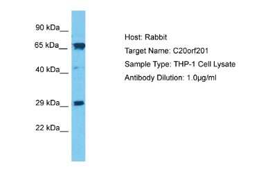 Western Blot: LKAAEAR1 Antibody [NBP1-91428]