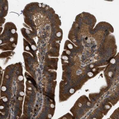 Immunohistochemistry-Paraffin: LKAP Antibody [NBP1-87854]