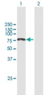 Western Blot: LKAP Antibody [H00009665-B01P]