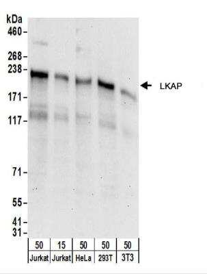 Western Blot: LKAP Antibody [NBP2-22257]