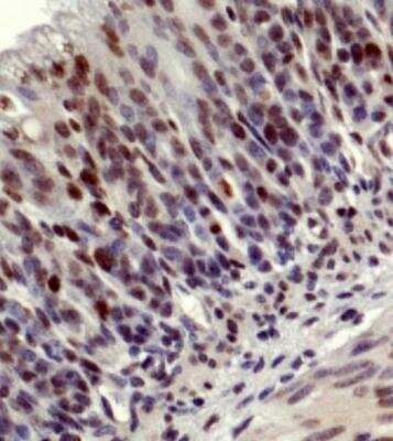Immunohistochemistry-Paraffin: LKB1/STK11 Antibody - BSA Free [NBP2-14835]