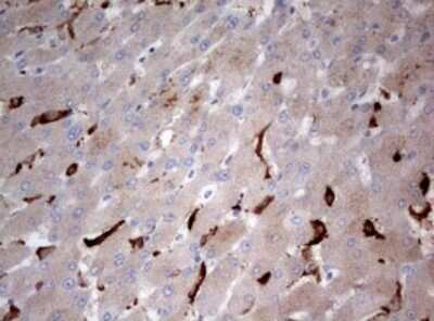 Immunohistochemistry: LKB1/STK11 Antibody (OTI0A3) [NBP2-45460]