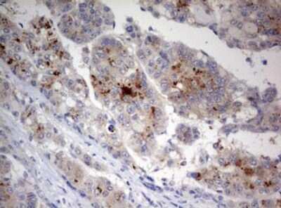 Immunohistochemistry: LKB1/STK11 Antibody (OTI0A3) [NBP2-45460]