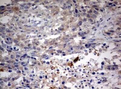 Immunohistochemistry: LKB1/STK11 Antibody (OTI0A3) [NBP2-45460]