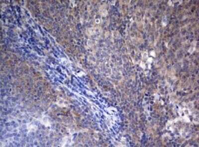 Immunohistochemistry: LKB1/STK11 Antibody (OTI0A3) [NBP2-45460]