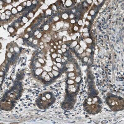 Immunohistochemistry-Paraffin: LKB1/STK11 Antibody [NBP1-87817]