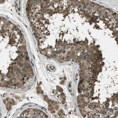 Immunohistochemistry-Paraffin: LKB1/STK11 Antibody [NBP1-87817]