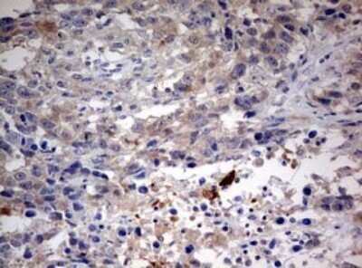 Immunohistochemistry: LKB1/STK11 Antibody (OTI0A3) - Azide and BSA Free [NBP2-71300]