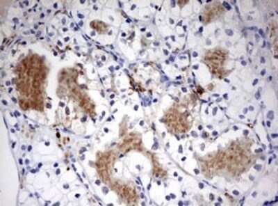 Immunohistochemistry: LKB1/STK11 Antibody (OTI0A3) - Azide and BSA Free [NBP2-71300]