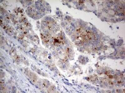 Immunohistochemistry: LKB1/STK11 Antibody (OTI0A3) - Azide and BSA Free [NBP2-71300]