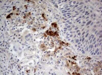 Immunohistochemistry: LKB1/STK11 Antibody (OTI0A3) - Azide and BSA Free [NBP2-71300]