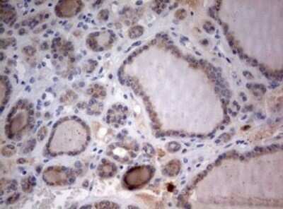 Immunohistochemistry: LKB1/STK11 Antibody (OTI0A3) - Azide and BSA Free [NBP2-71300]