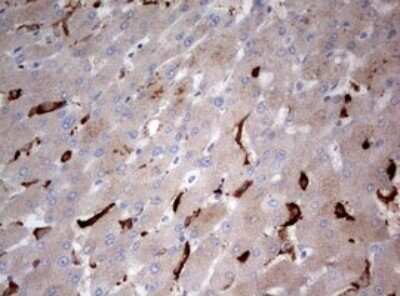 Immunohistochemistry: LKB1/STK11 Antibody (OTI0A3) - Azide and BSA Free [NBP2-71300]