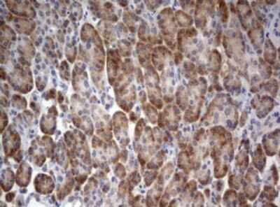 Immunohistochemistry: LKB1/STK11 Antibody (OTI0A3) - Azide and BSA Free [NBP2-71300]
