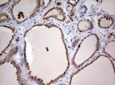 Immunohistochemistry: LKB1/STK11 Antibody (OTI0A3) - Azide and BSA Free [NBP2-71300]