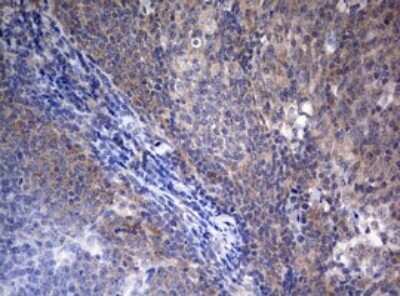 Immunohistochemistry: LKB1/STK11 Antibody (OTI0A3) - Azide and BSA Free [NBP2-71300]