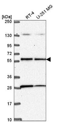 Western Blot: LKB1/STK11 Antibody [NBP2-56895]