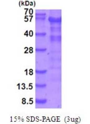 SDS-PAGE: Recombinant Human LKB1/STK11 His Protein [NBP2-51959]