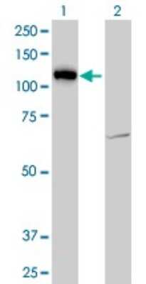 Western Blot: LLGL2 Antibody (4G2) [H00003993-M06]