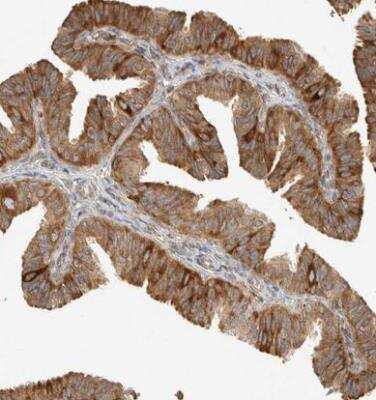 Immunohistochemistry-Paraffin: LLGL2 Antibody [NBP1-81753]