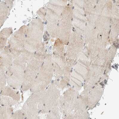 Immunohistochemistry-Paraffin: LLGL2 Antibody [NBP1-81753]